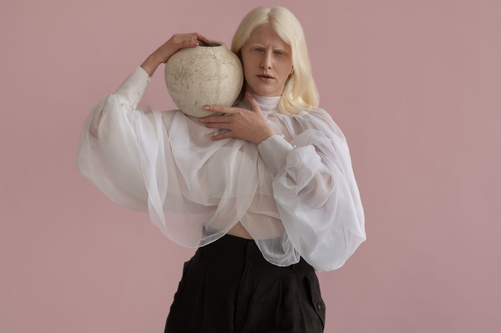 vue-de-face-femme-atteinte-d-albinisme-posant-en-studio